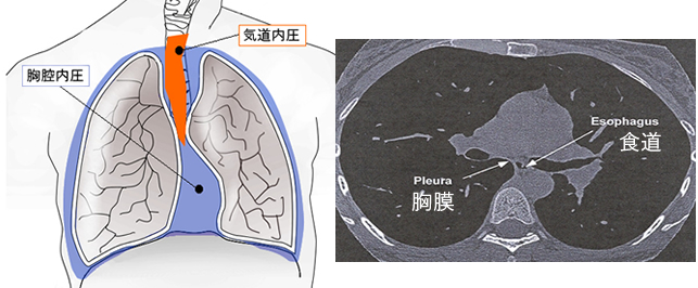 食道内圧測定の準備