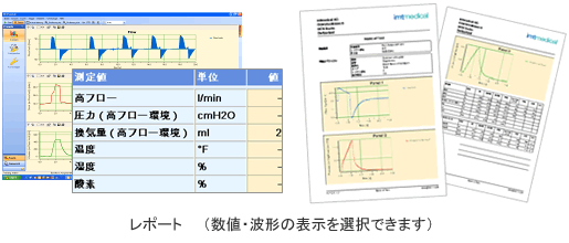 リアルタイムの数値、波形はもちろん、約100時間のトレンドデータも取得