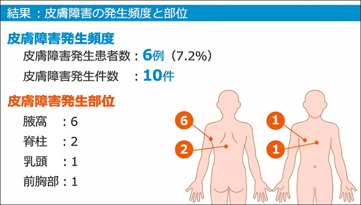 皮膚障害発生頻度及び発生部位
