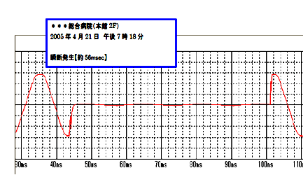 電源調査を実施したところ、人工呼吸器を接続使用していた電源系統で瞬停が発生している事が判明した例